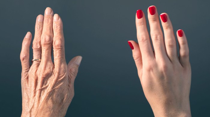 Age reversal therapy
